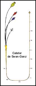 Desenho explicativo do Catter de Swan-ganz